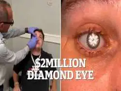 تصاویر| چشم مصنوعی با الماس 2 قیراطی مردی که شبیه شرورهای جیمز باند است!