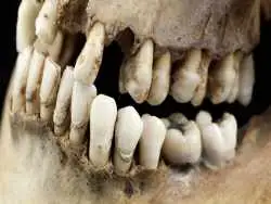 چگونه یک دندان 1600 ساله راز «زن ریاضت کش» را فاش کرد؟